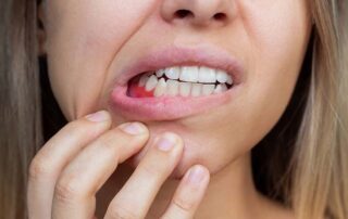 gum bleeding