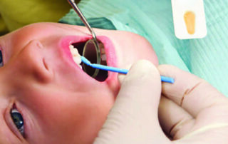 Kid's Dentistry in Hyderabad