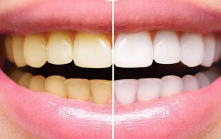 Dental treatment