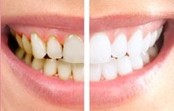 gum